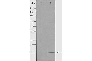 Western blot analysis of extracts of HeLa  using H3R8me2s antibody. (Histone 3 anticorps  (H3R8me2))