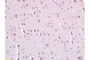 Formalin-fixed and paraffin embedded rat brain labeled with Anti-Phospho-SIRT1(Ser47) Polyclonal Antibody, Unconjugated (ABIN745658) at 1:200 followed by conjugation to the secondary antibody and DAB staining (SIRT1 anticorps  (pSer47))