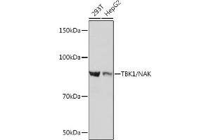 Western blot analysis of extracts of various cell lines, using TBK1/NAK Rabbit mAb (ABIN7270723) at 1:1000 dilution.