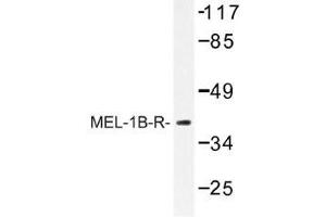 Image no. 1 for anti-Melatonin Receptor 1B (MTNR1B) antibody (ABIN317757) (Melatonin Receptor 1B anticorps)