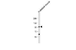 Anti-YY1 Antibody (Center)at 1:2000 dilution + human skeletal muscle lysates Lysates/proteins at 20 μg per lane. (YY1AP1 anticorps  (AA 437-468))
