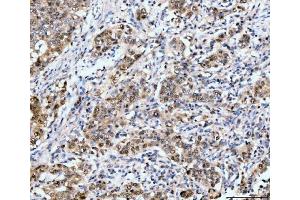 IHC analysis of Neurofibromin/NF1 using anti-Neurofibromin/NF1 antibody (ABIN7600196).