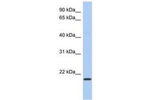 Image no. 1 for anti-RWD Domain Containing 4 (RWDD4) (C-Term) antibody (ABIN6743711) (RWDD4A anticorps  (C-Term))