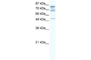 WB Suggested Anti-DDX46 Antibody Titration:  1. (DDX46 anticorps  (C-Term))