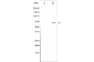Western blot analysis of LIMK1/2 phosphorylation expression in HeLa whole cell lysates,The lane on the left is treated with the antigen-specific peptide. (LIMK-1/2 (pThr505), (pThr508) anticorps)