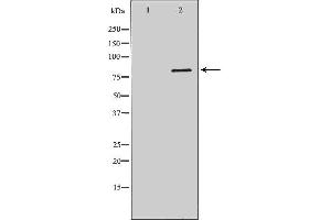 Western blot analysis of Hela whole cell lysates, using DCLRE1C Antibody. (DCLRE1C anticorps  (C-Term))