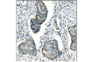 IHC analysis of ANGPT2 using anti-ANGPT2 antibody (ABIN7601450). (Angiopoietin 2 anticorps  (AA 357-404))