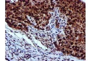 Image no. 5 for anti-EPM2A (Laforin) Interacting Protein 1 (EPM2AIP1) antibody (ABIN1498045) (EPM2AIP1 anticorps)