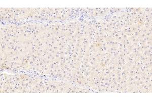 Detection of IL12B in Human Liver Tissue using Monoclonal Antibody to Interleukin 12B (IL12B) (IL12B anticorps  (AA 30-320))