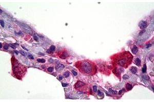 Anti-HSD11B1 antibody IHC staining of human lung, macrophages. (HSD11B1 anticorps)