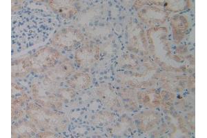 IHC-P analysis of Human Kidney Tissue, with DAB staining. (ALIX anticorps  (AA 174-383))