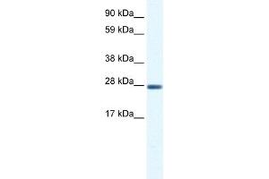 WB Suggested Anti-CLIC1 Antibody Titration:  0.