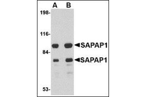 Western blot analysis of SAPAP1 in rat brain tissue lysate with this product at (A) 0. (DLGAP1 anticorps  (Center))