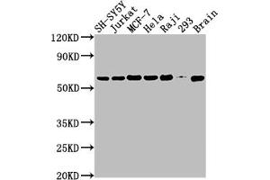 Western Blot Positive WB detected in: SH-SY5Y whole cell lysate, Jurkat whole cell lysate, MCF-7 whole cell lysate, Hela whole cell lysate, Raji whole cell lysate, 293 whole cell lysate, Mouse brain tissue All lanes: PKM antibody at 1:2000 Secondary Goat polyclonal to rabbit IgG at 1/50000 dilution Predicted band size: 58, 59, 57 kDa Observed band size: 58 kDa (Recombinant PKM anticorps)