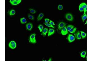 Immunofluorescent analysis of MCF-7 cells using ABIN7167443 at dilution of 1:100 and Alexa Fluor 488-congugated AffiniPure Goat Anti-Rabbit IgG(H+L)