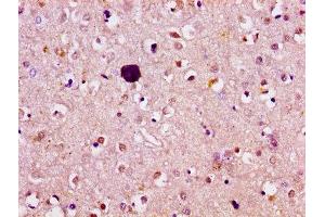 IHC image of ABIN7144809 diluted at 1:100 and staining in paraffin-embedded human brain tissue performed on a Leica BondTM system. (ATL1 anticorps  (AA 220-350))