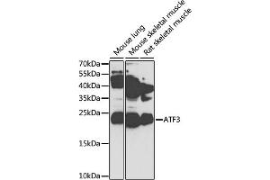 Western blot analysis of extracts of various cell lines, using  antibody (ABIN3023657, ABIN3023658, ABIN3023659, ABIN1678765 and ABIN6218982) at 1:1000 dilution. (ATF3 anticorps  (AA 1-181))