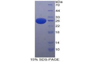 SDS-PAGE analysis of Human PAFAH1B3 Protein. (PAFAH1B3 Protéine)