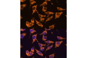 Immunofluorescence analysis of L929 cells using CAMKV antibody (ABIN7266051) at dilution of 1:100.