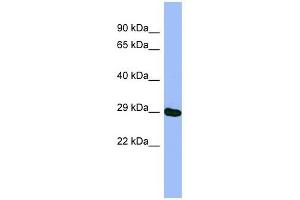 METTL5 antibody used at 1 ug/ml to detect target protein. (METTL5 anticorps  (N-Term))