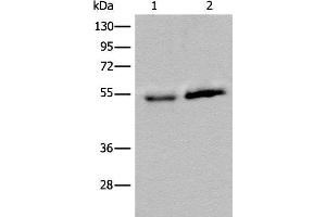 Western blot analysis of Human fetal intestines tissue and Human breast cancer tissue lysates using CCDC85C Polyclonal Antibody at dilution of 1:400 (CCDC85C anticorps)