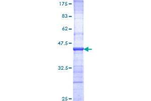 Image no. 1 for Nibrin (NBN) (AA 645-754) protein (GST tag) (ABIN1312044)