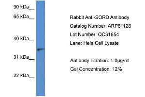 Western Blotting (WB) image for anti-Sorbitol Dehydrogenase (SORD) (N-Term) antibody (ABIN2788686) (SORD anticorps  (N-Term))