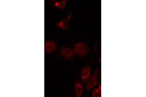 ABIN6275003 staining A549 by IF/ICC.