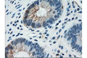 Image no. 10 for anti-Keratin 18 (KRT18) (AA 69-372) antibody (ABIN1491637)