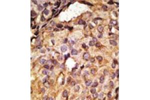 Image no. 3 for anti-Toll-Like Receptor 6 (TLR6) (C-Term) antibody (ABIN357055)