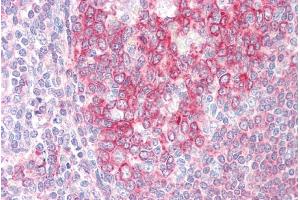 ABIN184723 (5µg/ml) staining of paraffin embedded Human Tonsil.