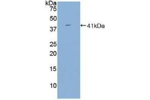 Detection of Recombinant BAFFR, Human using Polyclonal Antibody to B-Cell Activation Factor Receptor (BAFFR) (BAFF anticorps  (AA 96-184))