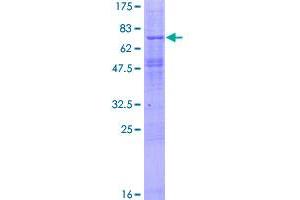 Image no. 1 for Osteomodulin (OMD) (AA 1-421) protein (GST tag) (ABIN1313387)