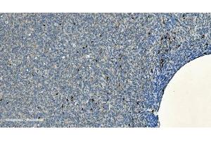 IHC analysis of CD20/MS4A1 using anti-CD20/MS4A1 antibody (ABIN7599233). (CD20 anticorps  (AA 1-297))