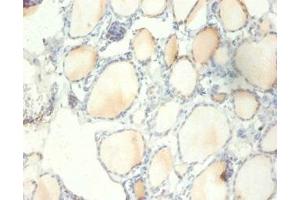 Immunohistochemistry of paraffin-embedded human thyroid tissue using ABIN7142488 at dilution of 1:100
