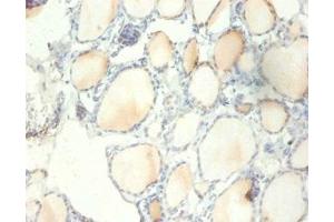 Immunohistochemistry of paraffin-embedded human thyroid tissue using ABIN7142488 at dilution of 1:100 (RPS13 anticorps  (AA 3-151))