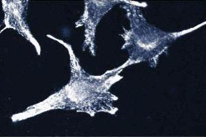 Immunofluorescence staining of CPAE cells (bovine pulmonary artery endothelial cells, ATCC CCL-209). (PTPRZ1 anticorps  (AA 2098-2307))