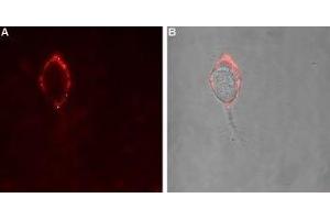 Expression of GABA(A) α4 Receptor in rat PC12 cells - Cell surface detection of GABA(A) α4 Receptor in intact living rat pheochromocytoma PC12 cells.
