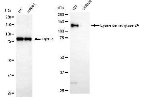 Western blotting analysis using lysine demethylase 2A antibody (ABIN7799299).