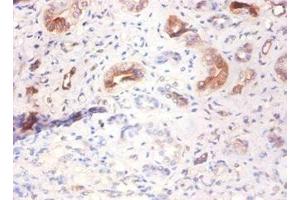 Immunohistochemistry of paraffin-embedded human kidney tissue using ABIN7143786 at dilution of 1:100 (Fetuin A anticorps  (AA 20-296))