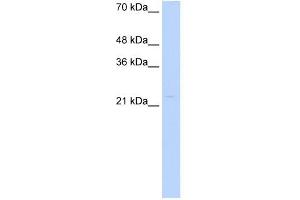 WB Suggested Anti-CDX4 Antibody Titration: 0. (CDX4 anticorps  (Middle Region))
