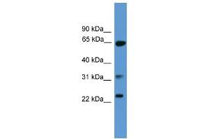 WB Suggested Anti-CLTA Antibody Titration: 0. (CLTA anticorps  (C-Term))