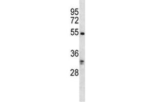 RIPK3 antibody western blot analysis in K562 lysate.