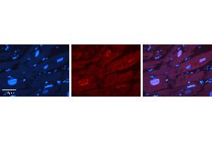 Rabbit Anti-ERF Antibody   Formalin Fixed Paraffin Embedded Tissue: Human heart Tissue Observed Staining: Nucleus Primary Antibody Concentration: 1:100 Other Working Concentrations: 1:600 Secondary Antibody: Donkey anti-Rabbit-Cy3 Secondary Antibody Concentration: 1:200 Magnification: 20X Exposure Time: 0. (ERF anticorps  (N-Term))
