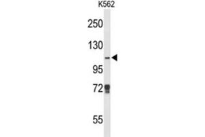 Western Blotting (WB) image for anti-Lysine (K)-Specific Demethylase 4B (KDM4B) antibody (ABIN3004159) (KDM4B anticorps)