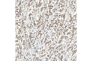 IHC analysis of SNPH using anti-SNPH antibody (ABIN7601724). (Syntaphilin anticorps  (AA 43-482))
