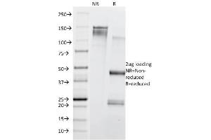 SDS-PAGE Analysis Purified CD71 Mouse Monoclonal Antibody (TFRC/1839). (Transferrin Receptor anticorps  (AA 94-212))