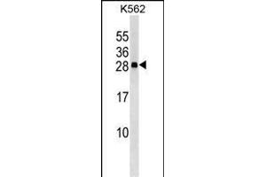 CXXC4 Antibody (C-term) (ABIN653333 and ABIN2842821) western blot analysis in K562 cell line lysates (35 μg/lane). (CXXC4 anticorps  (C-Term))