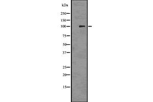 Western blot analysis of PMEL17 / GP100 using 293 whole cell lysates