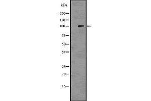Western blot analysis of PMEL17 / GP100 using 293 whole cell lysates (Melanoma gp100 anticorps  (C-Term))